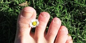 Nail fungus on the feet